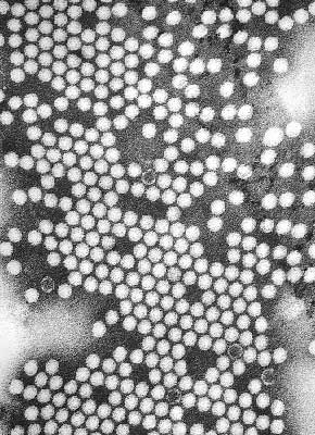 virus-polio