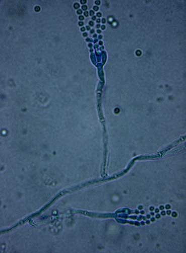 penicillium