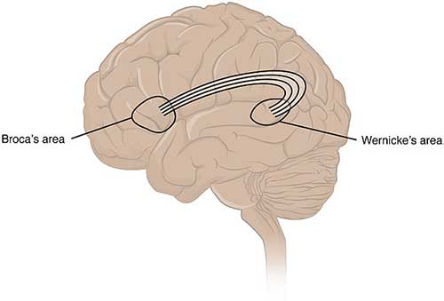 broca-dan-wernicke