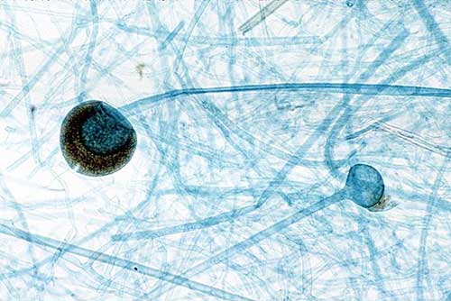 sporangia-rhizopus