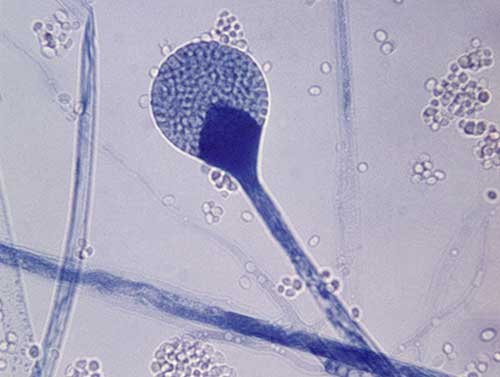 sporangium